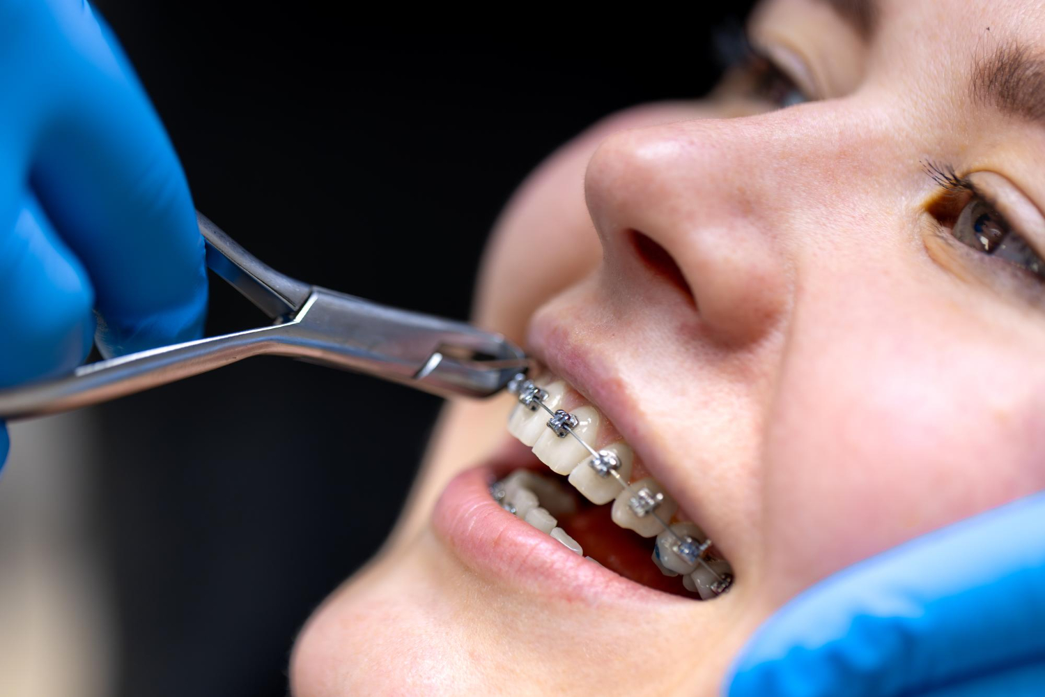 Orthodontics and Braces